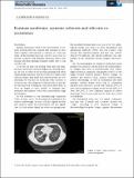 Int J of Rheum Dis - 2018 - Sarı Sürmelİ - Erasmus syndrome  systemic sclerosis and silicosis co‐occurrence.pdf.jpg